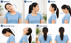 5 bài tập giúp cải thiện độ linh hoạt cột sống cổ