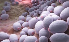 Đau rát vùng miệng, lưỡi kéo dài cảnh giác với nấm miệng họng do Candida