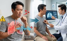 Người già ho dai dẳng sau khi ăn: Khi nào cần khám hô hấp?