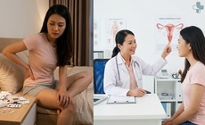 Uống kháng sinh xong bị ngứa vùng kín, có phải nấm Candida?