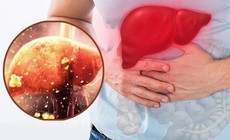 7 dấu hiệu tổn thương gan 