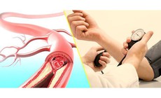 Có phải cứ chóng mặt là do cao huyết áp?
