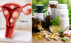 Người bệnh u xơ tử cung nên thận trọng với những thực phẩm chức năng nào?