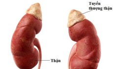 Nhận biết sớm dấu hiệu suy tuyến thượng thận ở trẻ