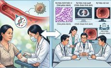 Xét nghiệm ctDNA có quyết định việc hóa trị sau mổ ung thư đại tràng?