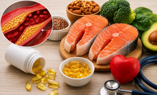 Người bị mỡ máu cao có nên uống omega-3 mỗi ngày?