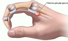 Ngón tay đau hoặc bật lò xo, cảnh giác với viêm gân gấp ngón tay