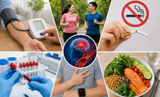 6 việc nên làm mỗi ngày giảm nguy cơ đột quỵ, bảo vệ não bộ