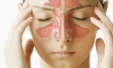 5 yếu tố làm tăng nguy cơ viêm xoang