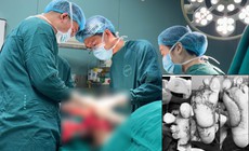 Suýt mất 2 bàn chân vì tự chườm nóng tại nhà khi bị tê bì