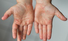 Dung dịch sát khuẩn tay chân miệng cho trẻ loại nào an toàn, giá tốt?