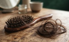 Rụng tóc hơn 100 sợi mỗi ngày có đáng lo?