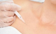 Ổ mủ xen lẫn filler trong ngực cô gái 24 tuổi