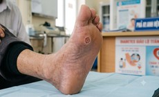 5 nhóm người không nên ngâm chân