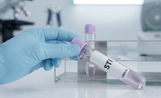 Xét nghiệm STI là gì và khi nào nên xét nghiệm?