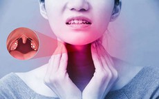 Viêm họng do liên cầu có triệu chứng gì?