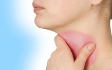 Viêm thanh quản có dẫn đến ung thư không?