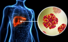 Sống khỏe với HIV và viêm gan C - tương lai đầy hy vọng cho người đồng nhiễm