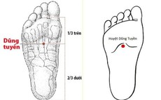 B&#225;c sĩ y học cổ truyền khuyến c&#225;o một số biện ph&#225;p ph&#242;ng ngừa đột quỵ v&#224;o m&#249;a lạnh