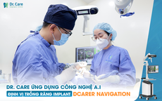 Trồng răng số 5 gi&#225; bao nhi&#234;u - lựa chọn trồng răng Implant sao cho đ&#250;ng?