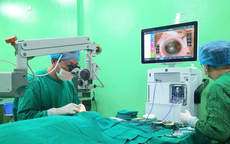 Bệnh đục thủy tinh thể (cườm kh&#244;) – G&#243;c nh&#236;n chuy&#234;n s&#226;u về nguy&#234;n nh&#226;n v&#224; chỉ định điều trị từ b&#225;c sĩ chuy&#234;n khoa