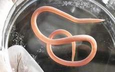 Giun đũa ở người g&#226;y biến chứng nguy hiểm g&#236;, kh&#225;m ở đ&#226;u?