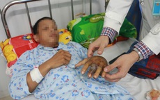 Bệnh viện tuyến tỉnh cứu sống nam thanh niên bị rắn cực độc cắn nguy kịch