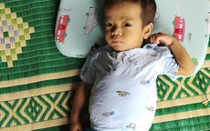 Xót xa hoàn cảnh bé trai bị teo mật bẩm sinh, mẹ sẵn sàng hiến gan cứu con nhưng không đủ kinh phí điều trị