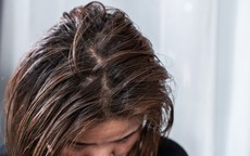 Vì sao mùa đông tóc nhanh bết hơn?