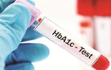 Ý nghĩa của xét nghiệm HbA1c trong bệnh đái tháo đường