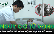 Giành giật sự sống cho bệnh nhân vỡ phình động mạch chủ bụng, nguy cơ tử vong cao