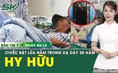 Bản tin Y tế 4/12: Ph&#225;t hiện chiếc bật lửa nằm trong dạ d&#224;y 30 năm 