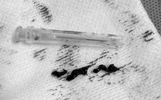 Cụ b&#224; nhiều bệnh nền tho&#225;t chết sau cơn đột quỵ trong nh&#224; vệ sinh