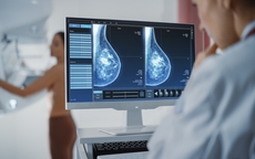 Ai nên chụp nhũ ảnh thường xuyên để phát hiện sớm ung thư vú?