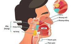 Ung thư đầu và cổ - Những điều nên biết