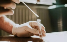 Xét nghiệm HPV tại nhà sàng lọc ung thư cổ tử cung