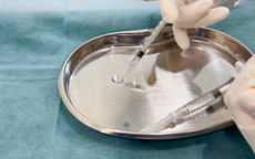 Filler bán tràn lan trên MXH, cách nào để nhận biết thật giả?