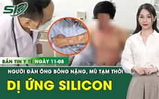 Bản Tin Y Tế 11/8: Người đàn ông bỏng nặng, mù tạm thời do dị ứng silicon