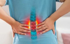 Thói quen dễ gây đau lưng những ngày cận Tết
