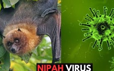 Bộ Y tế yêu cầu sẵn sàng đáp ứng các sự cố lây truyền bệnh 
của virus Nipah có thể xảy ra do thực phẩm