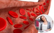 5 thói quen hàng ngày bảo vệ động mạch khỏi xơ vữa