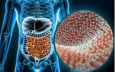 Cách nuôi dưỡng ‘bộ não thứ hai’ khỏe mạnh?