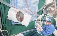 Kịp thời phẫu thuật lấy muỗng nhựa khỏi đường thở bé trai 4 tuổi