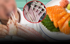 Ăn cá sống nhiều năm, người đàn ông phát hiện 'sinh vật' dài 4,5m trong cơ thể