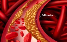 Triglyceride cao gây viêm tụy cấp nguy hiểm đe doạ tính mạng