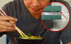 Người đàn ông nuốt chiếc đũa dài 12cm trong phút bốc đồng