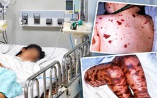 TPHCM ghi nhận ca não mô cầu mới tại xã Thường Tân