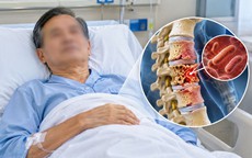 Cúm mãi không khỏi, người đàn ông 60 tuổi 'chết lặng' khi đi khám