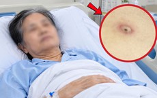 Người phụ nữ 62 tuổi phải cấp cứu chỉ vì 1 vết đốt nhỏ