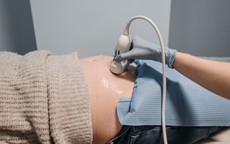 Giang mai bẩm sinh: Ngăn lây truyền từ mẹ sang con ngay từ thai kỳ